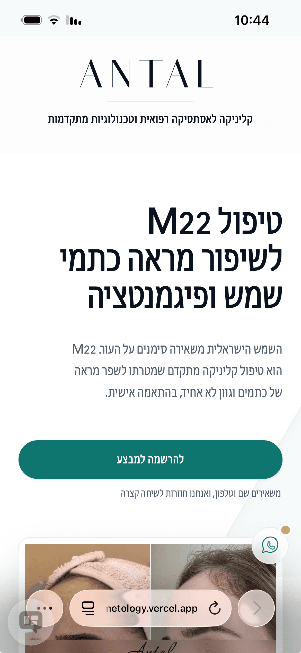 Antal Cosmetology — תצוגת מובייל