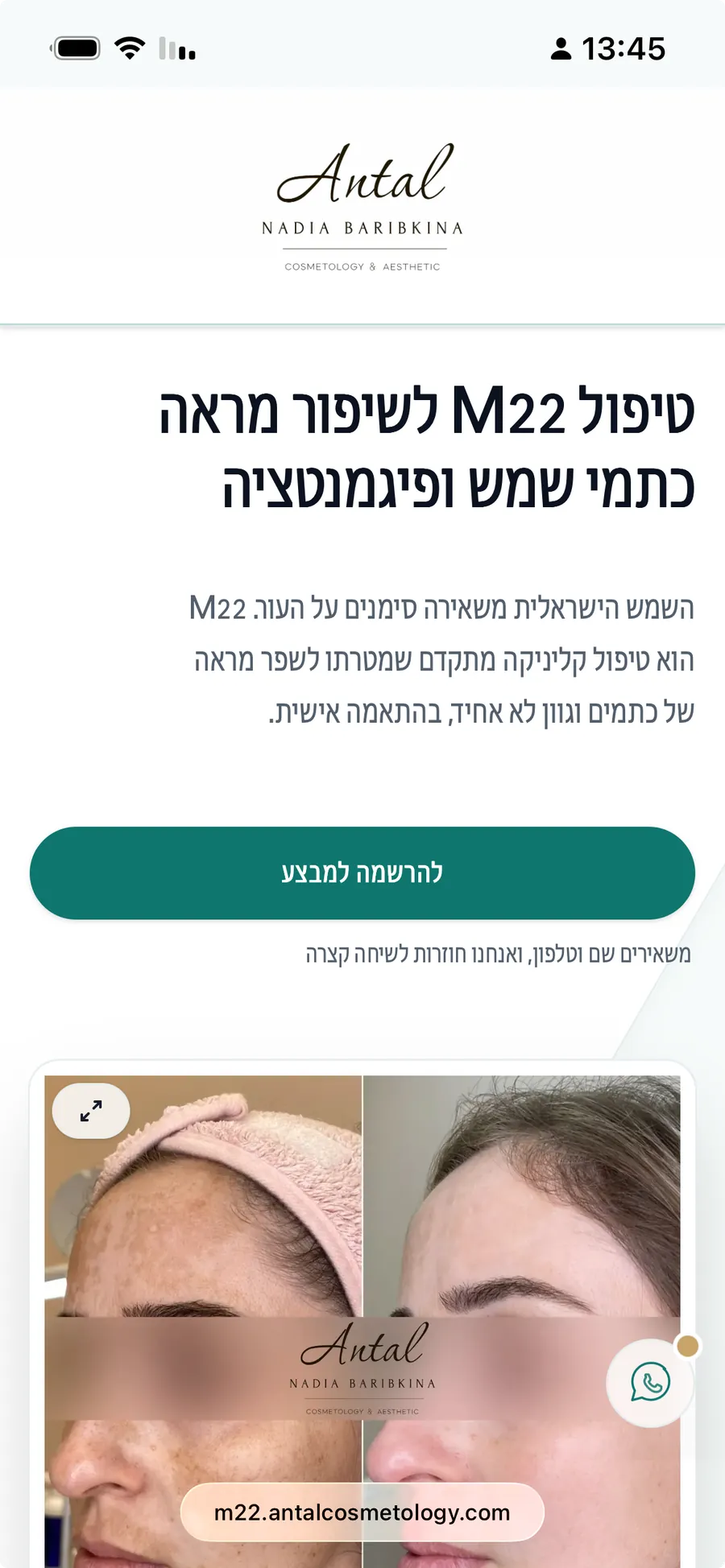 Antal Cosmetology mobile screen