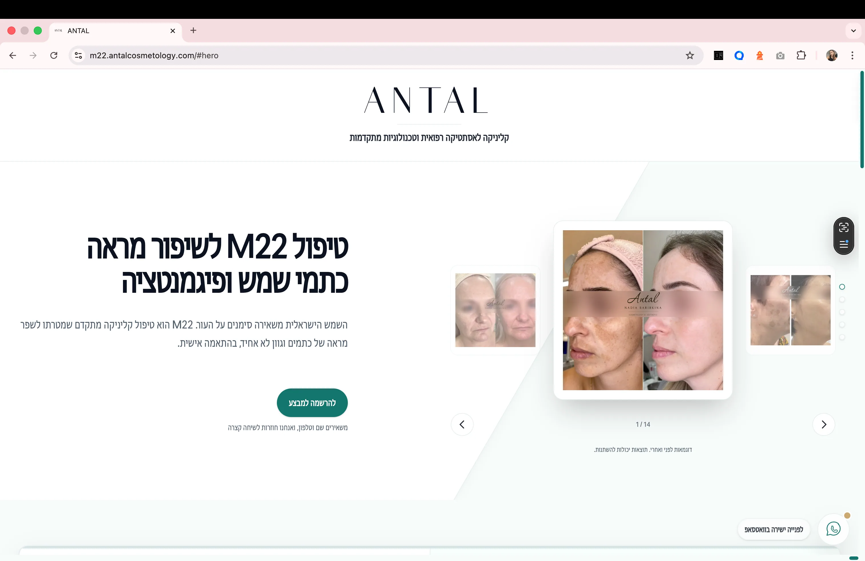 Antal Cosmetology desktop screen