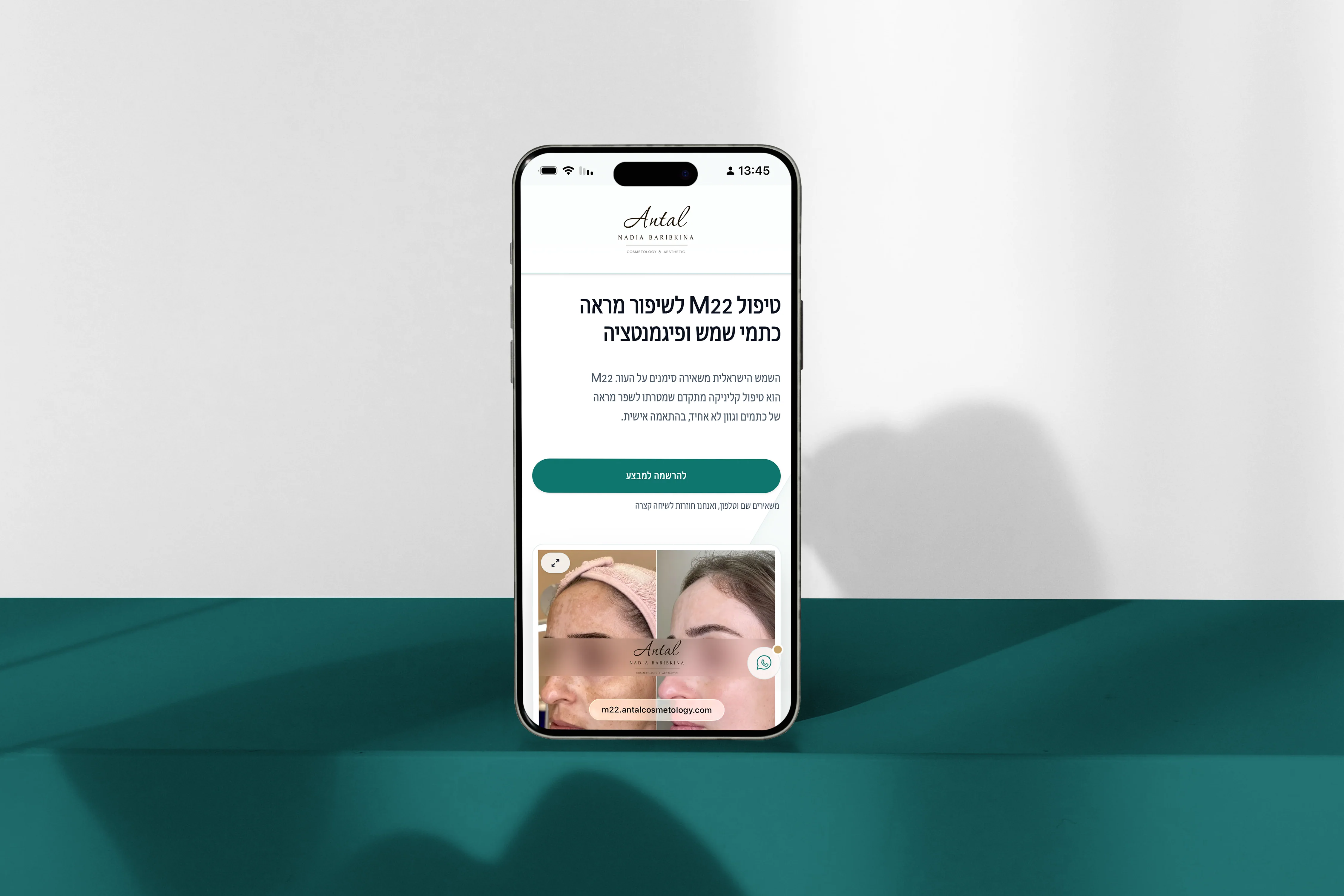 Antal Cosmetology iPhone mockup